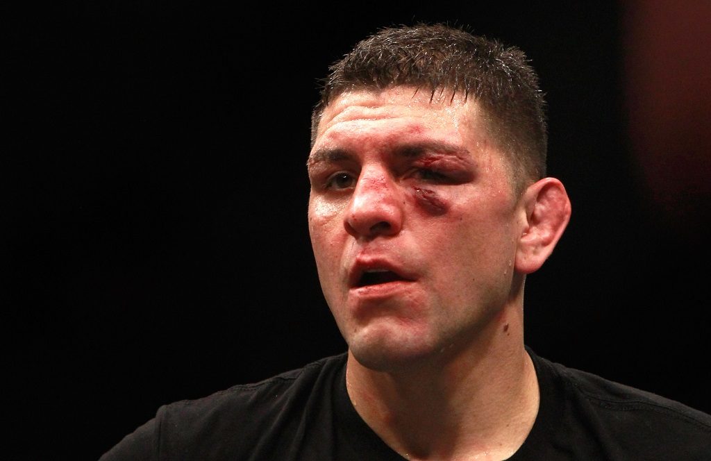 Nick Diaz looks beat up after a fight.