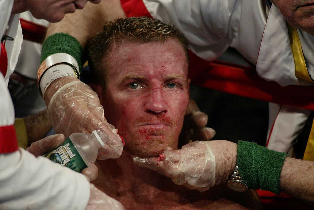 Micky Ward Is One of the Toughest Boxers of All Time but He's No Match for CTE