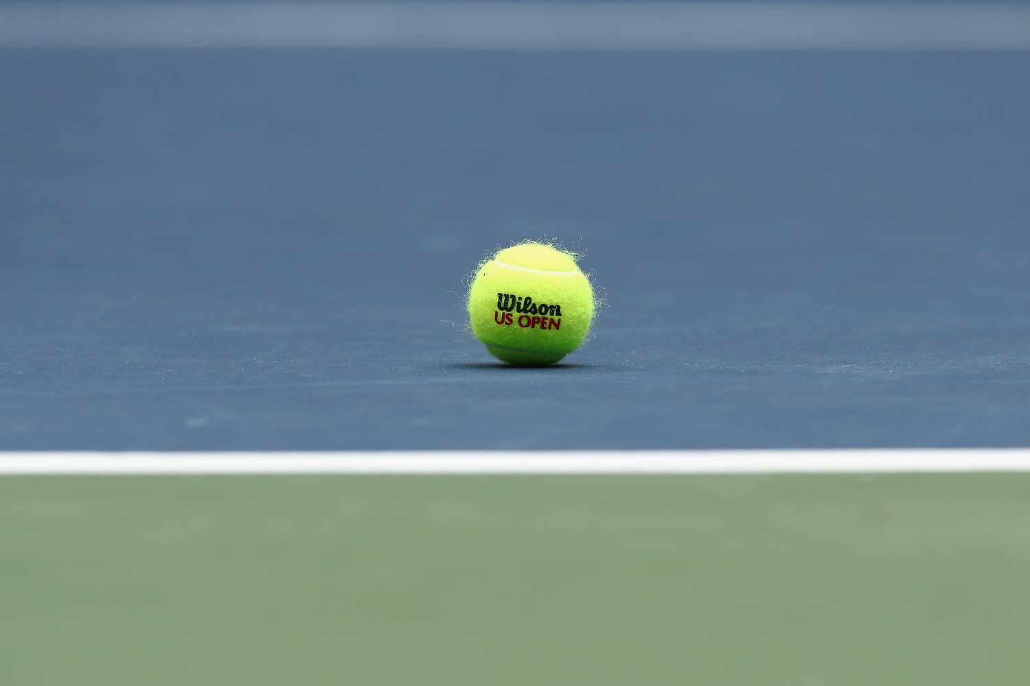 A Tennis Player Has Sold Her Right Arm for $5,000 in the NFT Craze