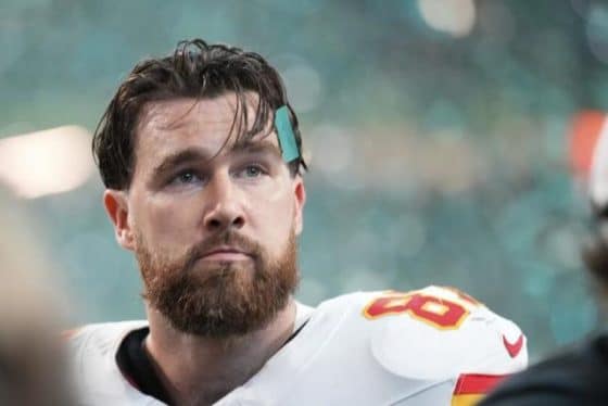 Travis Kelce On Super Bowl Loss: “My Life Is Still Beautiful”